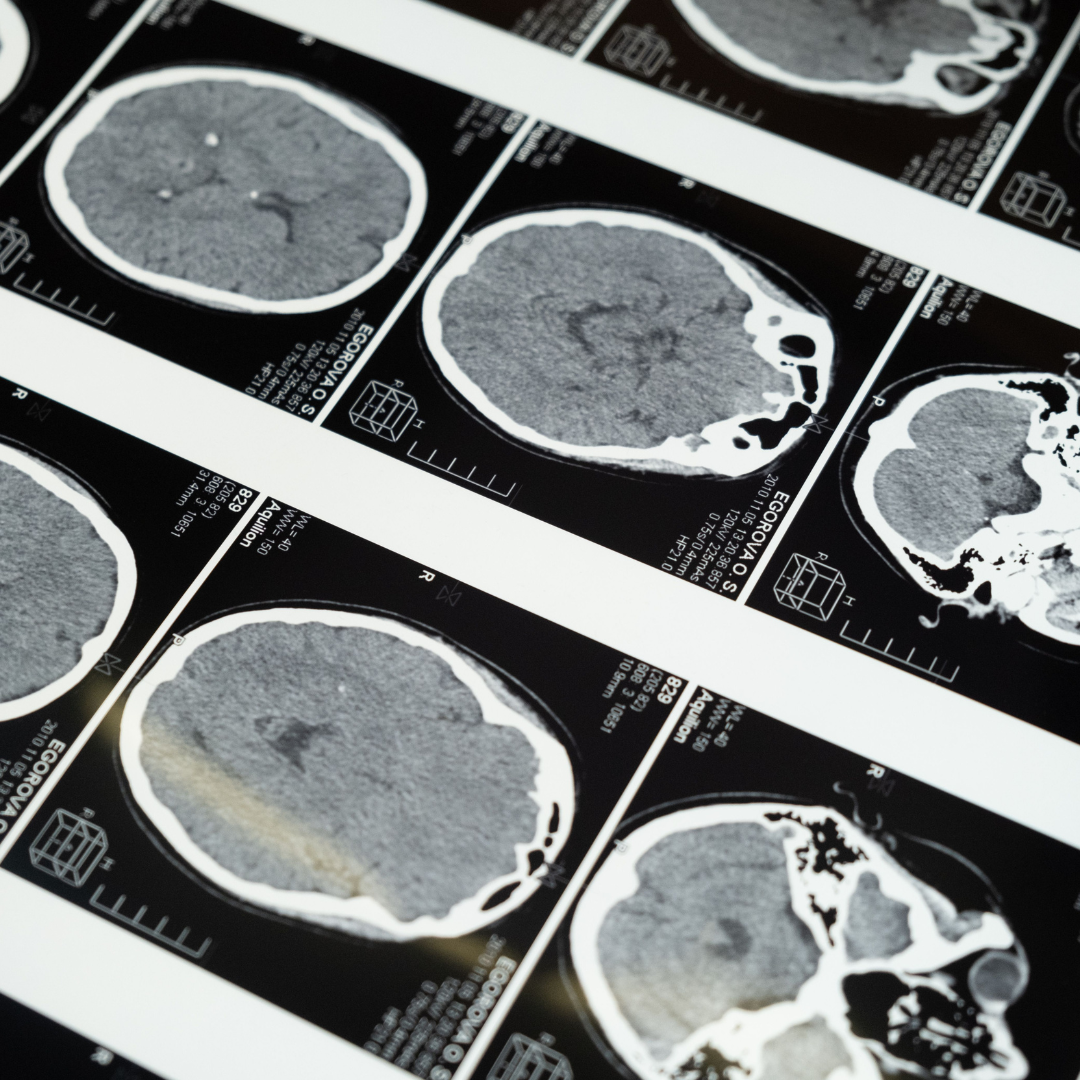Cognitive Function